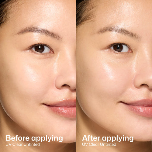 Elta MD UV Clear SPF 46
