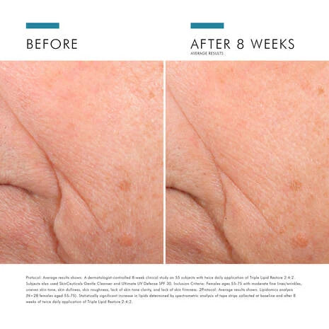 Skin Ceuticals C E Ferulic with 15% l-ascorbic acid