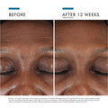 Skin Ceuticals A.G.E. Interrupter Advanced