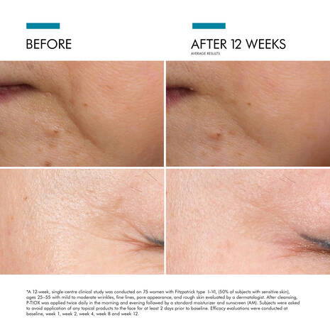 Skin Ceuticals P-tiox