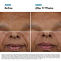Skin Ceuticals HA Intensifier Multi-Glycan