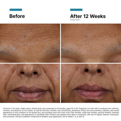Skin Ceuticals HA Intensifier Multi-Glycan