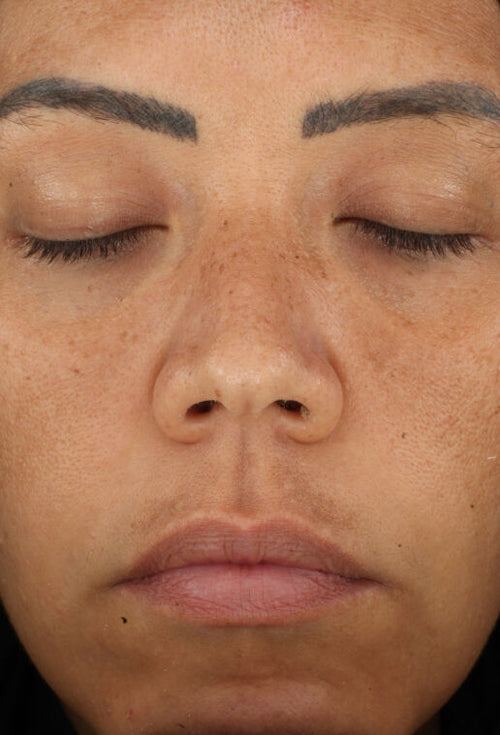 ZO Retinol Skin Brightener 1%