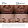 Skin Ceuticals Cell Cycle Catalyst