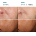 Skin Ceuticals Phloretin CF® with Ferulic Acid