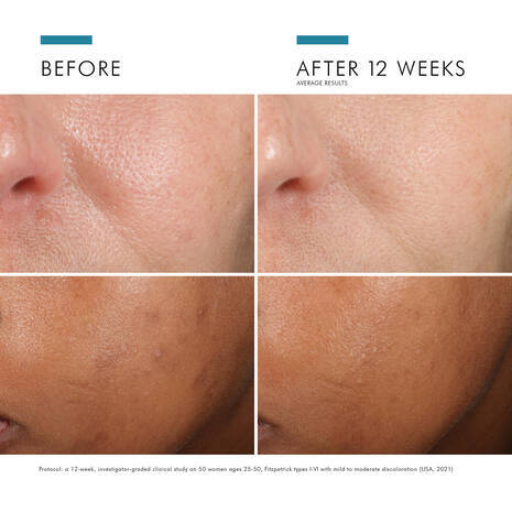 Skin Ceuticals Phloretin CF® with Ferulic Acid