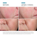 Skin Ceuticals Phyto Corrective Essence Mist