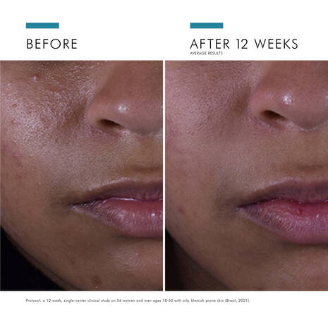 Skin Ceuticals Silymarin CF