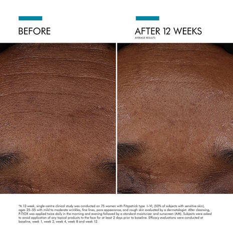 Skin Ceuticals P-tiox