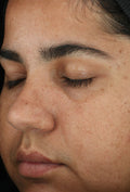 ZO Retinol Skin Brightener 1%