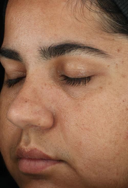 ZO Retinol Skin Brightener 1%