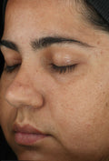 ZO Retinol Skin Brightener 1%